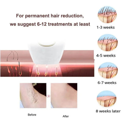 Full Body IPL Laser Hair Removal System & Glasses (Premium Quality)